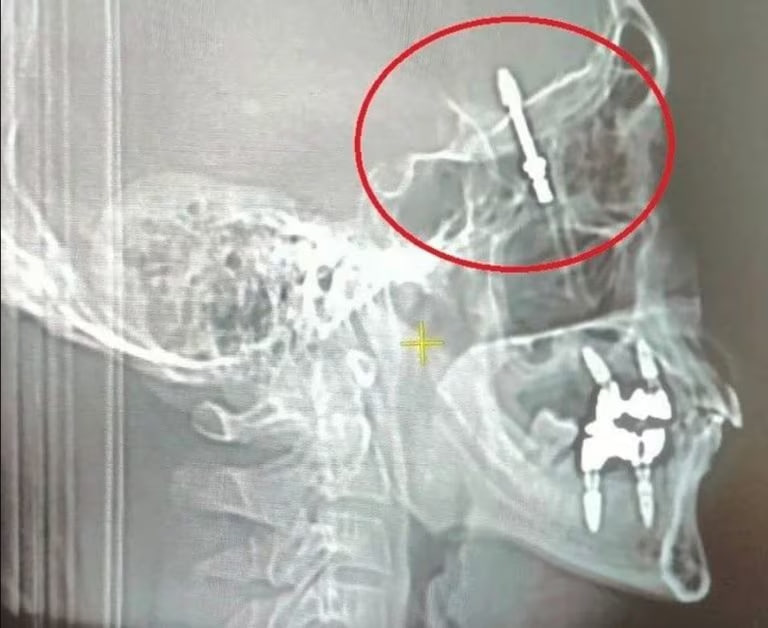 photo_2024-04-23_14-03-44